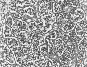 normal seromucinous salivary gland